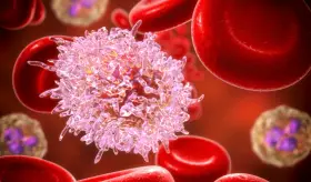 Avances terapéuticos y nuevas opciones de tratamiento en la lucha contra la leucemia linfocítica crónica