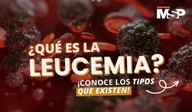 Leucemia: ¿Qué es y cuáles son sus tipos? - #ExclusivoMSP