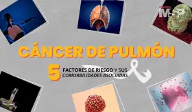 Cáncer de pulmón: 5 factores de riesgo y sus comorbilidades asociadas - #ExclusivoMSP
