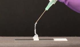 Gel inyectable sería la nueva promesa para atacar tumores sólidos de cáncer