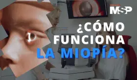 ¿Por qué se ve borroso en la miopía? - #ExclusivoMSP