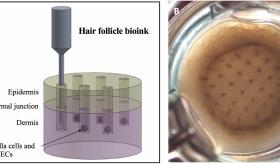 Logran bioimprimir folículos pilosos en 3D con piel cultivada en laboratorio