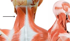 Descubren relación directa entre dolores de cabeza primarios e inflamación del cuello