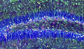 La autofagia o descomposición celular y su importancia en el proceso de regenerar neuronas en adultos
