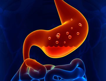 Qué es la gastritis y por qué la producción excesiva de ácido estomacal provoca úlceras gastroduodenales