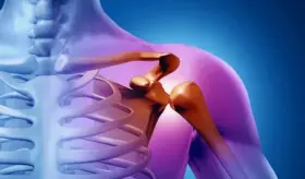 ¿Qué es una luxación? Esguince, rotura y complicaciones de la completa separación de huesos articulares