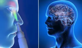 ¿Cómo funciona el innovador spray nasal de esketamina para tratar la depresión resistente?