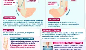 Esguince de tobillo | Infografía