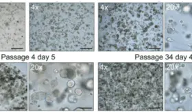 Científicos desarrollan modelo de tejido ocular humano en 3D que produce sus propias lágrimas