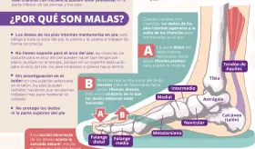 ¿Por qué no se deben usar las chanclas? | Infografía