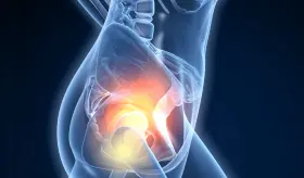 ¿Por qué la menopausia o menarquia precoz aumentan el riesgo de desarrollar artritis reumatoide?