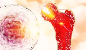 Primera terapia, única en su tipo, bloquearía ataque inmunitario frecuente por trasplantes de médula ósea