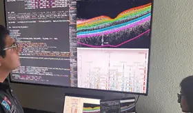 ¿Por qué la retina puede actuar como indicador para detectar enfermedades cardiacas, metabólicas o demencia