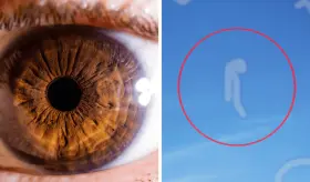 ¿Qué son las miodesopsias o moscas volantes que flotan a través del campo visual?