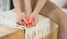 Neuroma de Morton y zapatos altos o deportes que engrosan el tejido alrededor de los nervios del pie