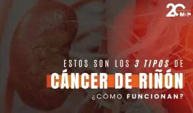 ¿Cuáles son los 3 tipos principales del cáncer de riñón? - #ExclusivoMSP