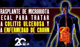 Trasplante de microbiota fecal para tratar Colitis ulcerosa y Enfermedad de Crohn - #EspecialMSP
