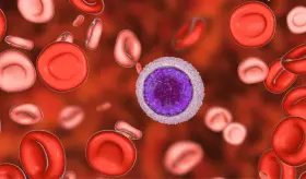 Seguimiento periódico de la leucemia linfocítica es más esencial que el propio tratamiento