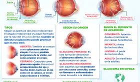 Día mundial del glaucoma | Infografía