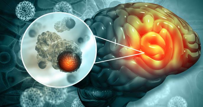 Fármacos para diabetes, colesterol y triglicéridos reducirían riesgo de cáncer cerebral en diábeticos