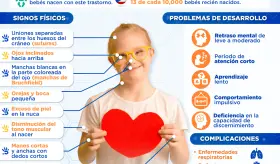 Día mundial del Síndrome de Down | Infografía