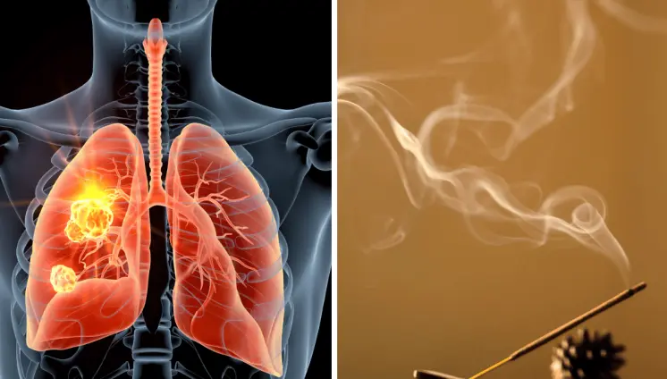 Exposición continua a incienso aumentaría el riesgo de cáncer de pulmón, leucemia o tumores cerebrales Exposición continua a incienso aumentaría el riesgo de cáncer de pulmón, leucemia o tumores cerebrales