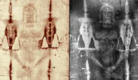 Análisis médico de las lesiones traumato-ortopédicas descubiertas en el Manto de Turín