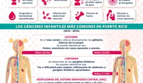 Cáncer infantil | Infografía