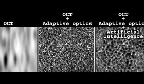 Inteligencia artificial 100 veces más rápida para obtener imágenes celulares del ojo y detectar enfermedades