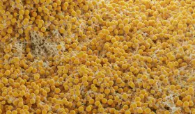 Sarcopenia: el problema oculto detrás del manejo de la obesidad que surge por los tratamientos o dietas