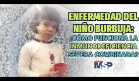 Enfermedad del niño burbuja: ¿Cómo funciona la inmunodeficiencia severa combinada? - #EspecialMSP
