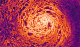 Respuesta antiviral: células nasales de los niños combaten el SARS-CoV-2 de manera eficaz