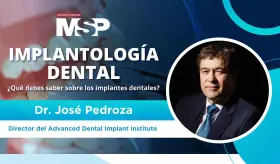 Implantología dental: ¿Qué debes saber sobre implantes dentales? - #ExclusivoMSP