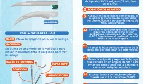 Intubación paso a paso | Infografía