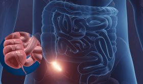 Apéndice podría estar involucrado en condiciones inflamatorias como colitis ulcerosa y cáncer colorrectal