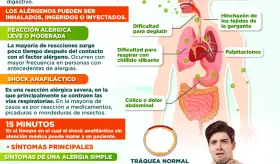 Una reacción alérgica que puede quitarle la vida | Infografía