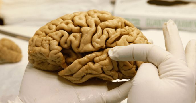 Identifican red cerebral responsable de la tartamudez y nuevas vías para su tratamiento