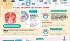 Dolor lumbar | Infografía