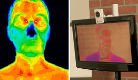 Temperatura facial podría ser clave para médicos en diagnóstico precoz de enfermedades metabólicas