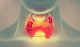 OMS advierte preocupante aumento de la deficiencia de yodo por dietas que evitan lácteos y sal yodada