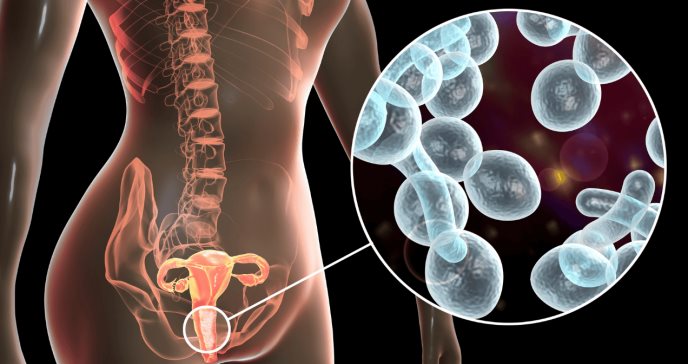 Descubren proteína que sería clave en desarrollo de nuevos antifúngicos efectivos contra candidiasis