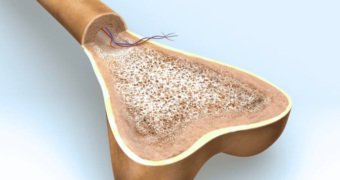 Científicos descubren hormona que crea hueso y desarrollan parche de hidrogel para tratar osteoporosis