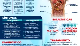 Día mundial del Síndrome de SjÖgren | Infografía