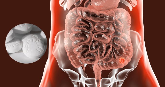 La aspirina reduce el riesgo de cáncer colorrectal en personas con factores de riesgo elevados: estudio