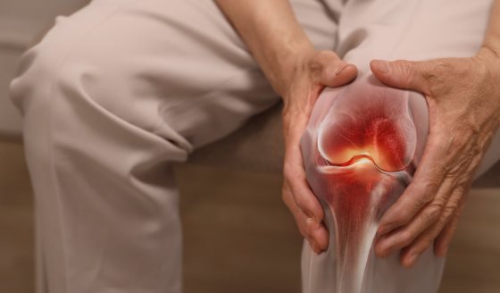 Aumenta los casos de pacientes de artritis reumatoide que no presentan inflamación en las articulaciones