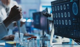 Fármaco aprobado contra el cáncer podría tratar la enfermedad de Alzheimer en etapa temprana
