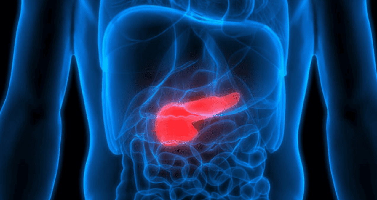 Anticuerpo humanizado podría mejorar la respuesta inmune contra el cáncer de páncreas