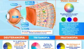 Día de concienciación sobre el daltonismo | Infografía