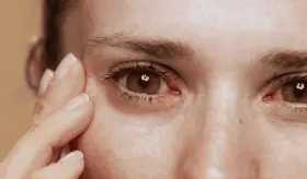 Pacientes de Sjögren tienen 10 a 20 veces más de riesgo de padecer algún tipo de linfoma, según estudio