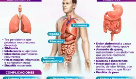 Día mundial de la fibrosis quística | Infografía